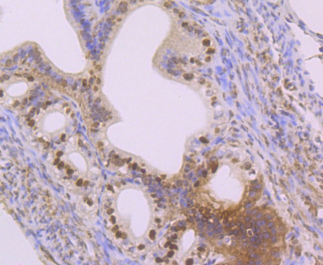 Anti-SET Antibody (3V307)