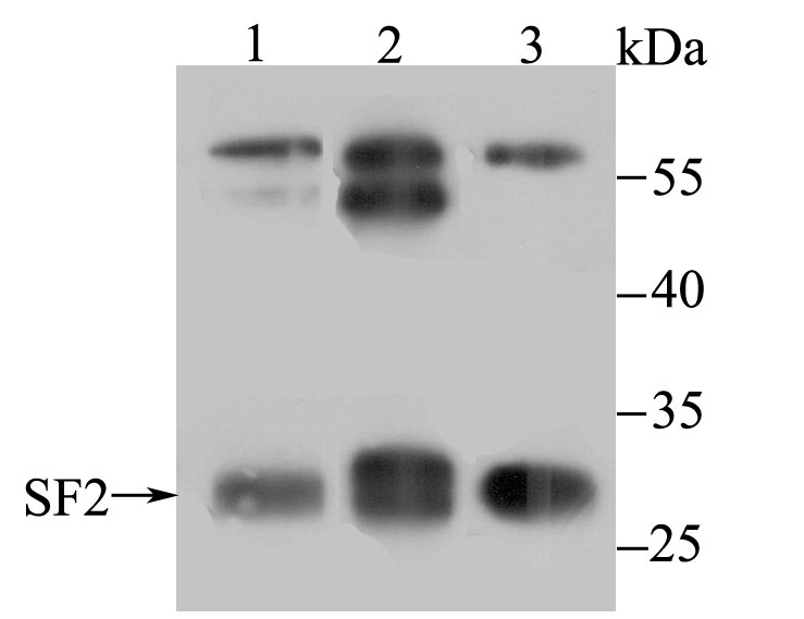 Anti-SRSF1 Antibody (4J752)