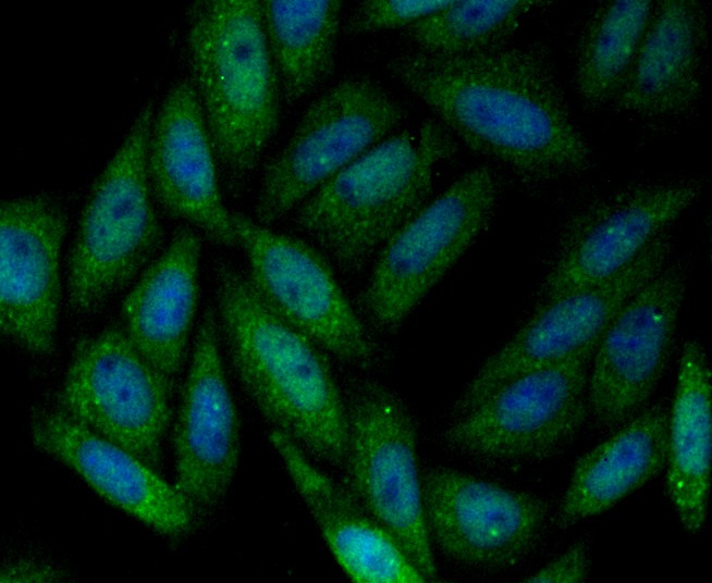 Anti-SENP1 Antibody (8Q886)