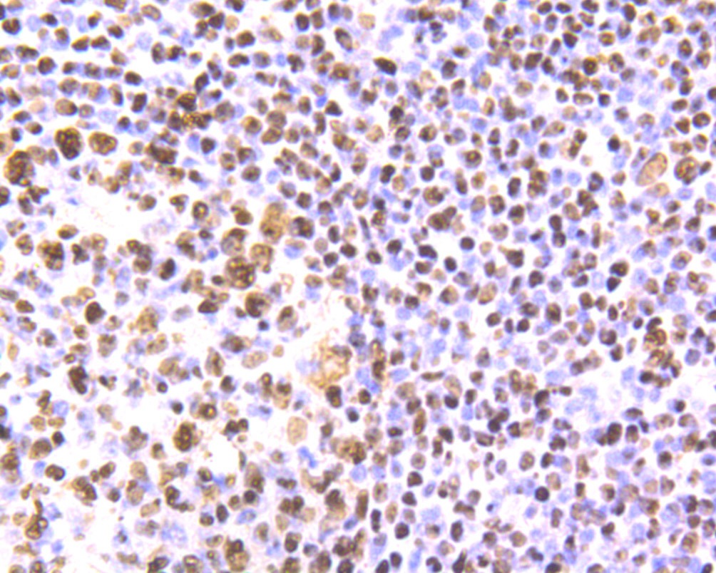 Anti-SET Antibody (3V307)