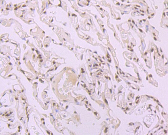 Anti-SRSF1 Antibody (4J752)