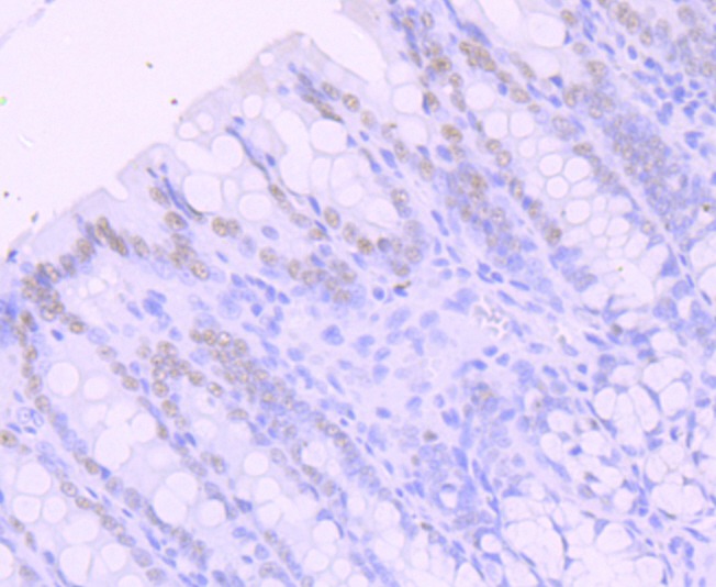 Anti-SATB2 Antibody (4X996)