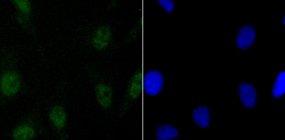 Anti-SATB2 Antibody (4X996)