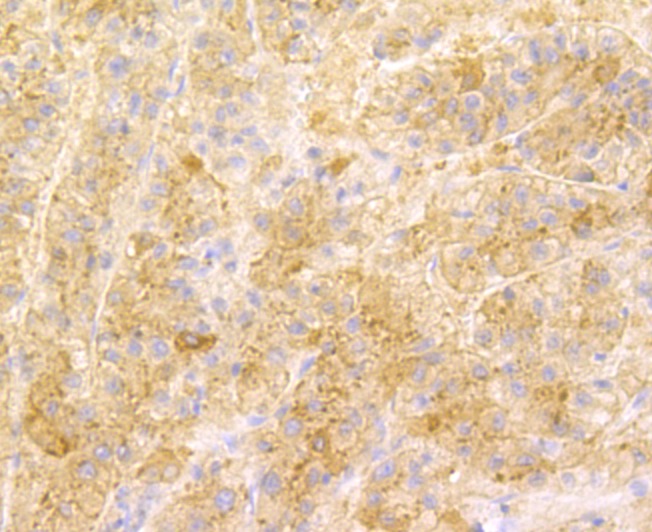 Anti-SENP1 Antibody (8Q886)