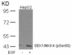 Anti-Phospho-MKK4 (Ser80) Polyclonal Antibody