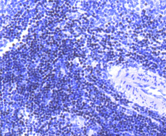 Anti-SATB1 Antibody (9Q281)