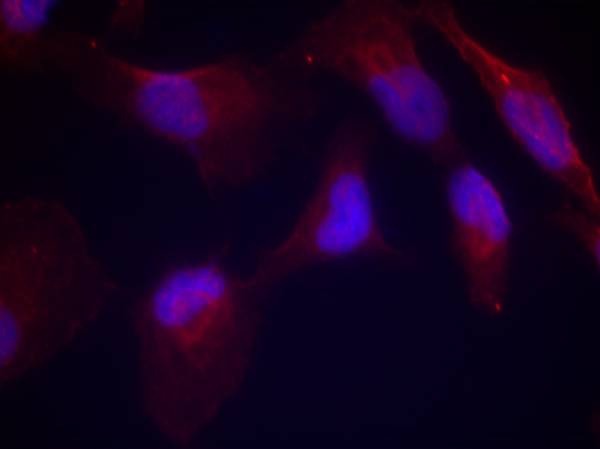 Anti-Phospho-MKK4 (Thr261) Polyclonal Antibody