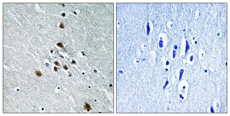 Anti-Phospho-SF1 (Ser82) Polyclonal Antibody