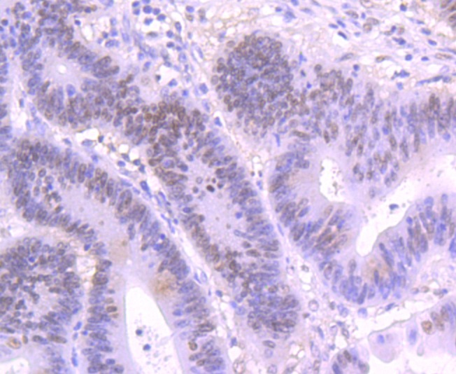 Anti-SATB2 Antibody (4X996)