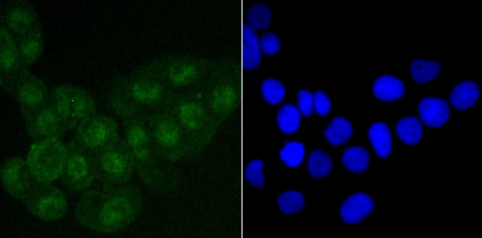 Anti-SATB2 Antibody (4X996)