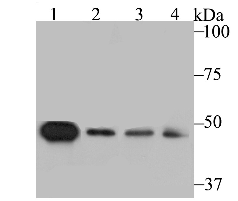 Anti-SFRP4 Antibody (1D887)