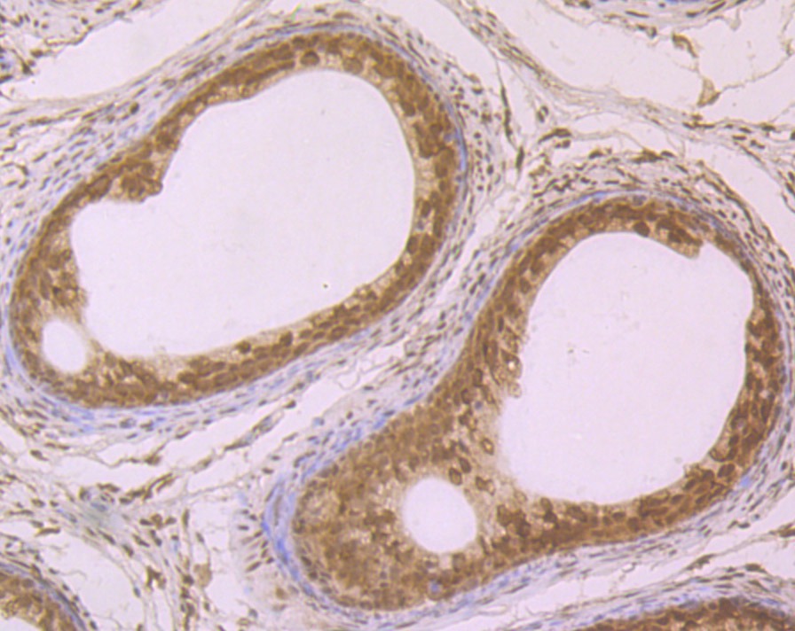 Anti-SRSF1 Antibody (4J752)