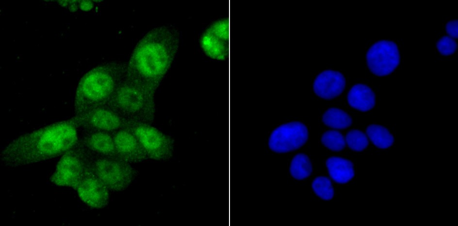 Anti-SAMHD1 Antibody (8T611)