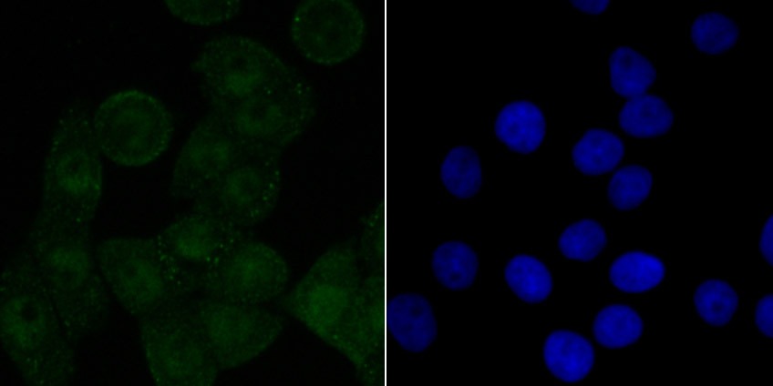 Anti-SET Antibody (3V307)