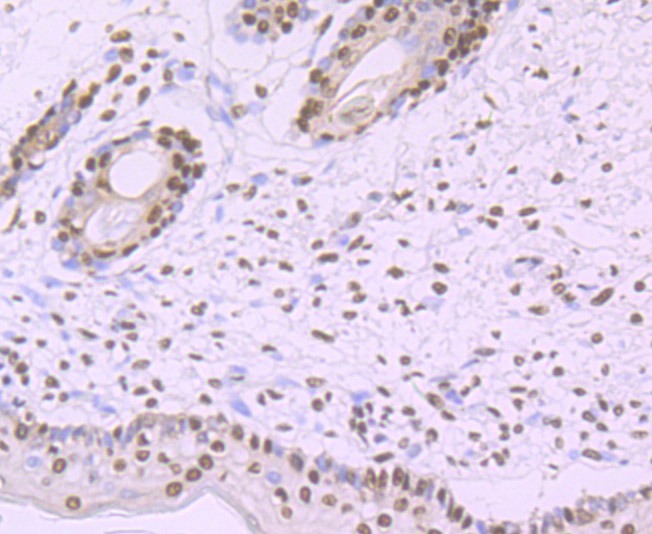 Anti-SF3B1 Antibody (5W363)