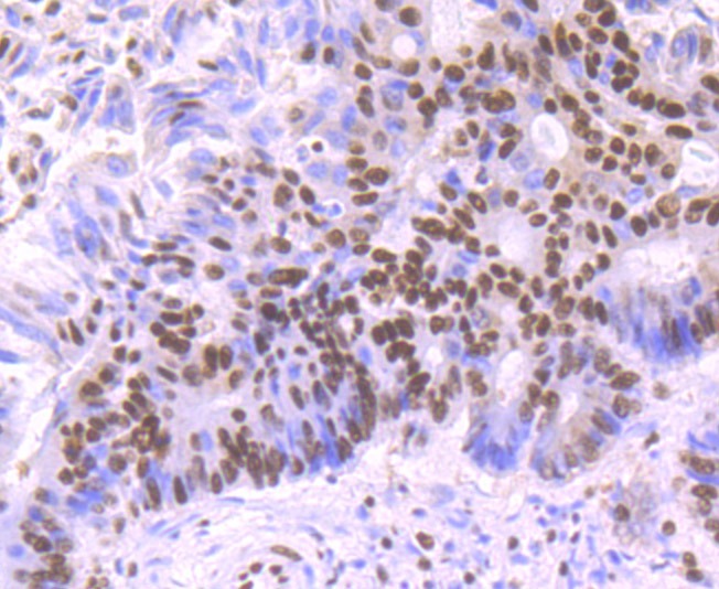 Anti-SF3B1 Antibody (5W363)