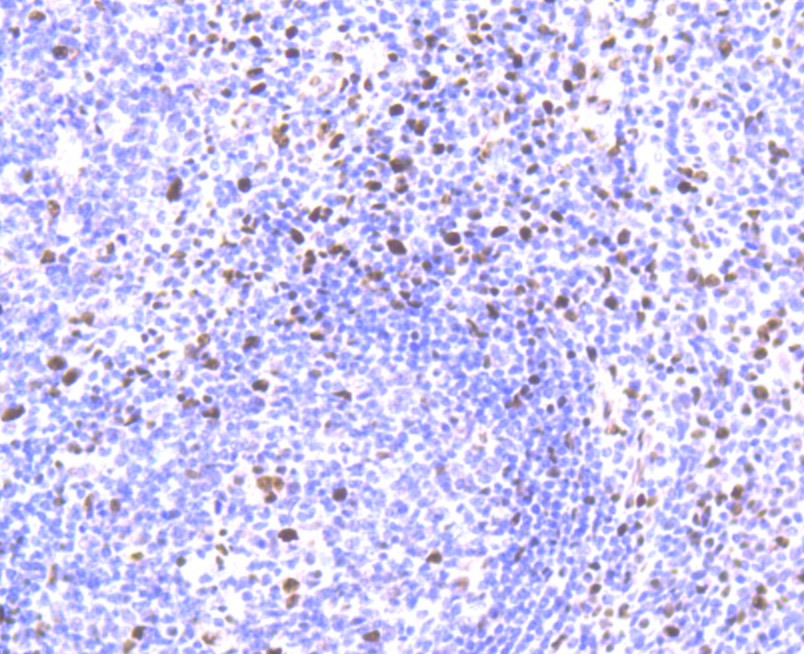 Anti-SAMHD1 Antibody (8T611)