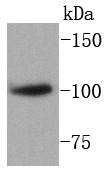Anti-SATB1 Antibody (9Q281)