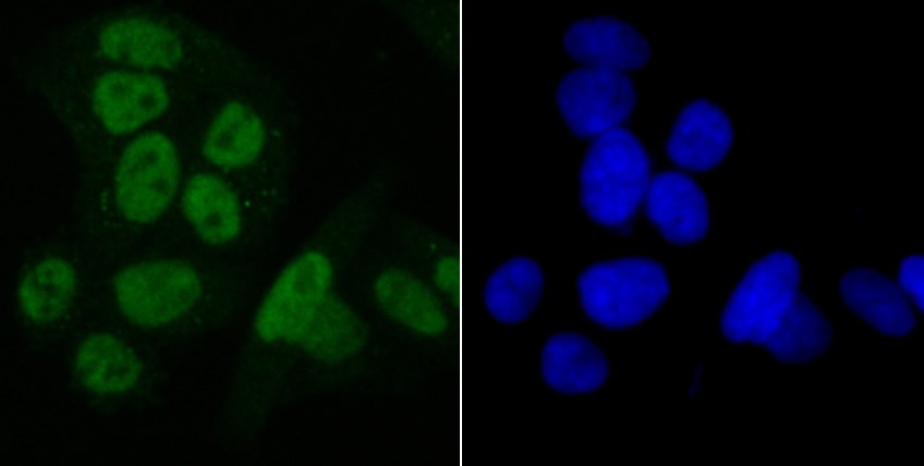 Anti-SET Antibody (3V307)