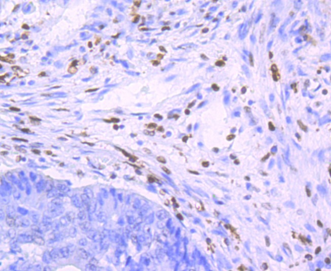 Anti-SAMHD1 Antibody (8T611)