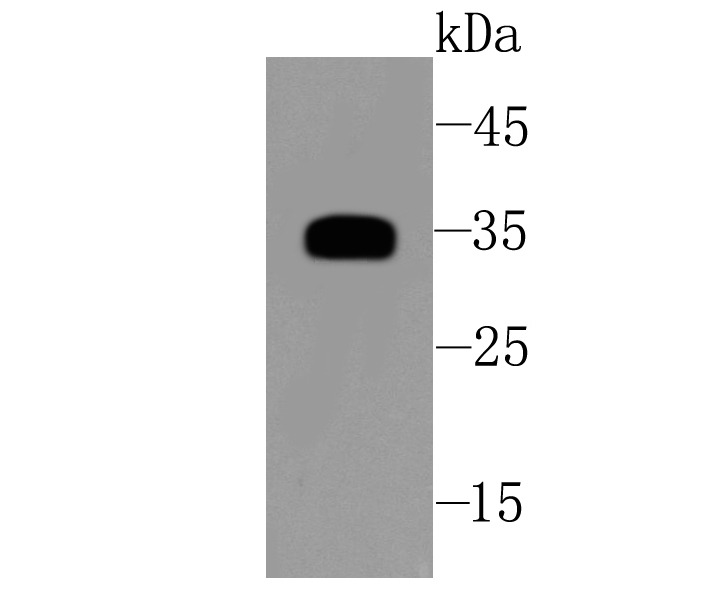 Anti-SFRP1 Antibody (5L352)
