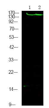 Anti-Phospho-ROCK2 (Tyr722) Polyclonal Antibody