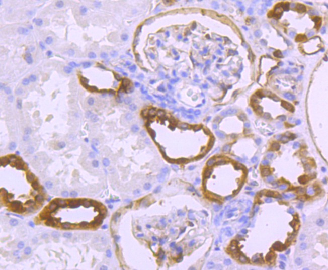 Anti-S100A10 Antibody (8Q369)