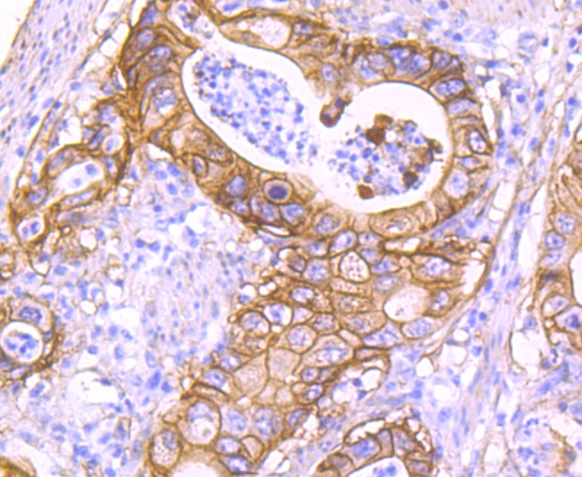 Anti-S100A10 Antibody (8Q369)