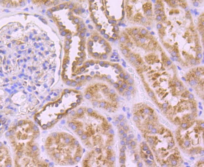 Anti-ATP2A2 Antibody (2R687)