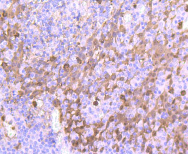 Anti-S100A9 Antibody (9D154)
