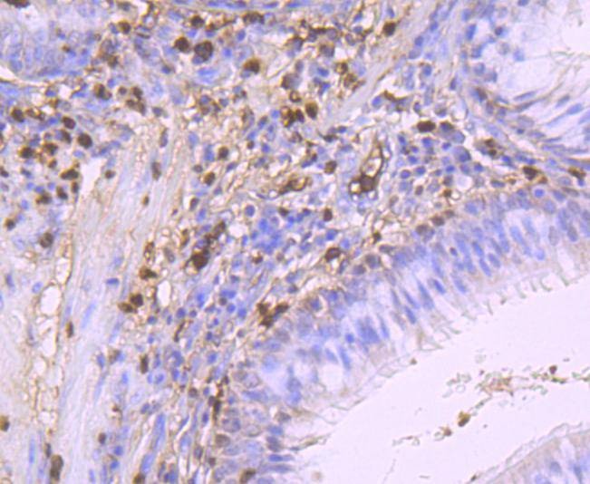 Anti-S100A9 Antibody (9D154)