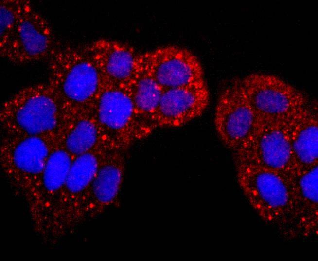 Anti-S100P Antibody (6W876)