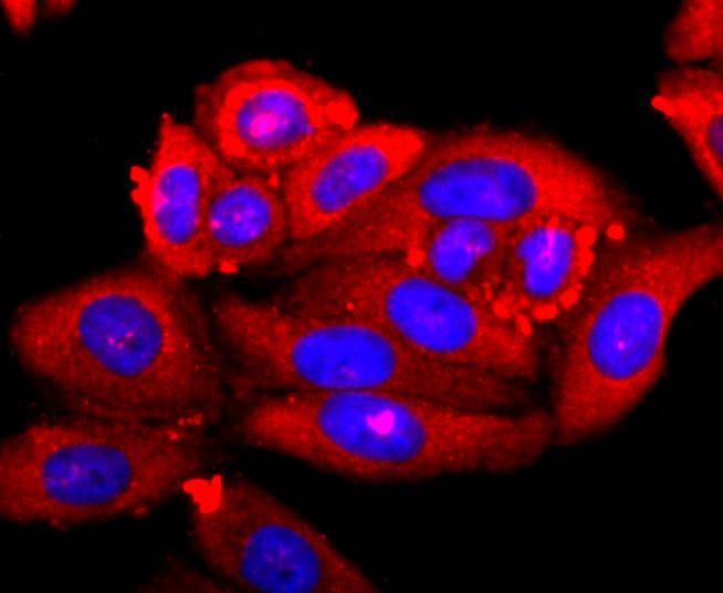Anti-S100A9 Antibody (9D154)