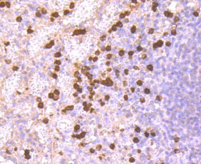 Anti-S100A9 Antibody (9D154)