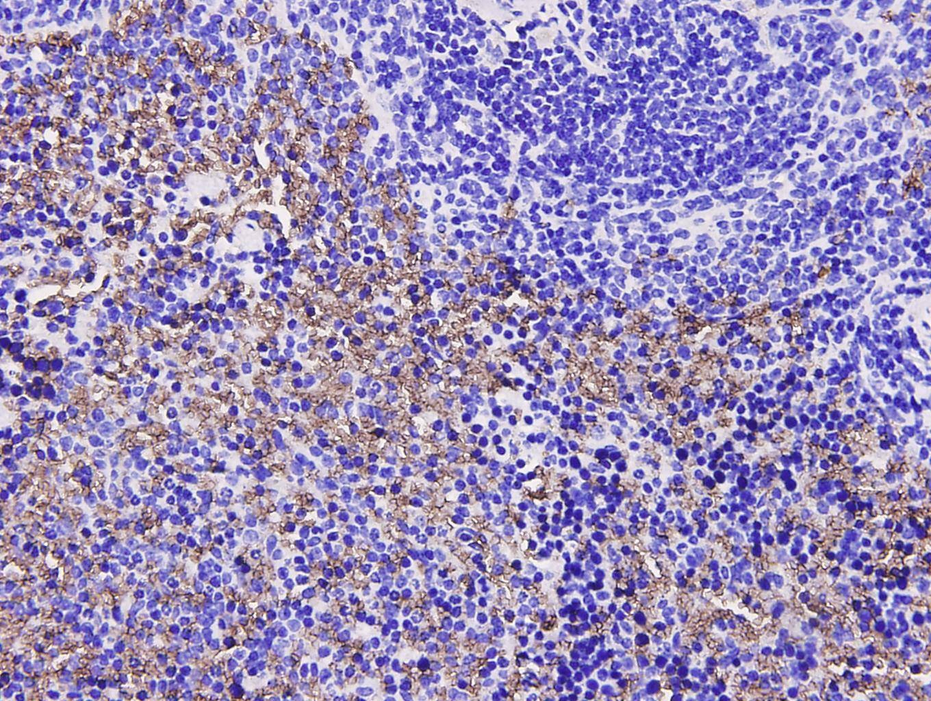 Anti-Sequestosome-1 Antibody (4X151)