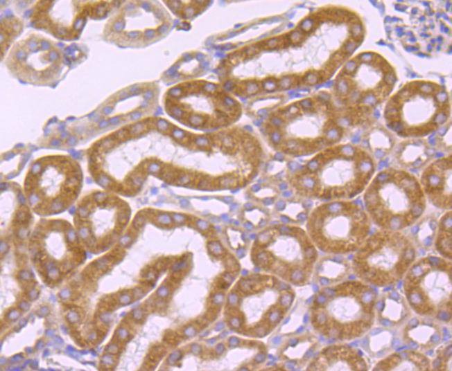 Anti-ATP2A2 Antibody (2R687)