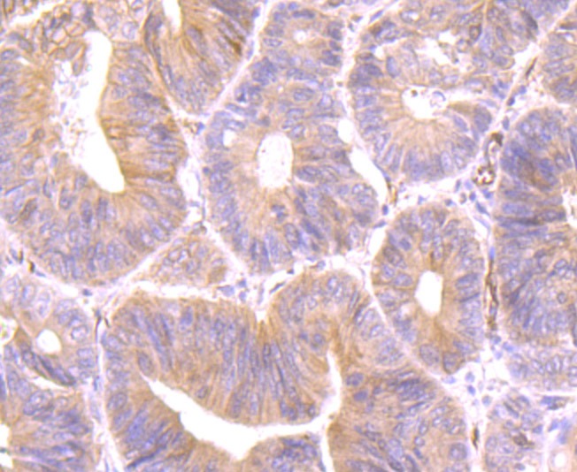 Anti-Securin Antibody (7P480)