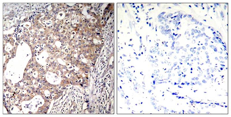 Anti-Phospho-Shc (Tyr427) Polyclonal Antibody