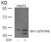 Anti-Phospho-Shc (Tyr349) Polyclonal Antibody