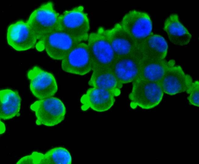 Anti-S100B Antibody (4A182)