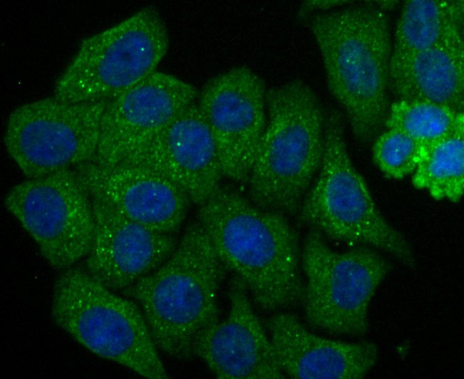 Anti-Septin 2 Antibody (7L577)
