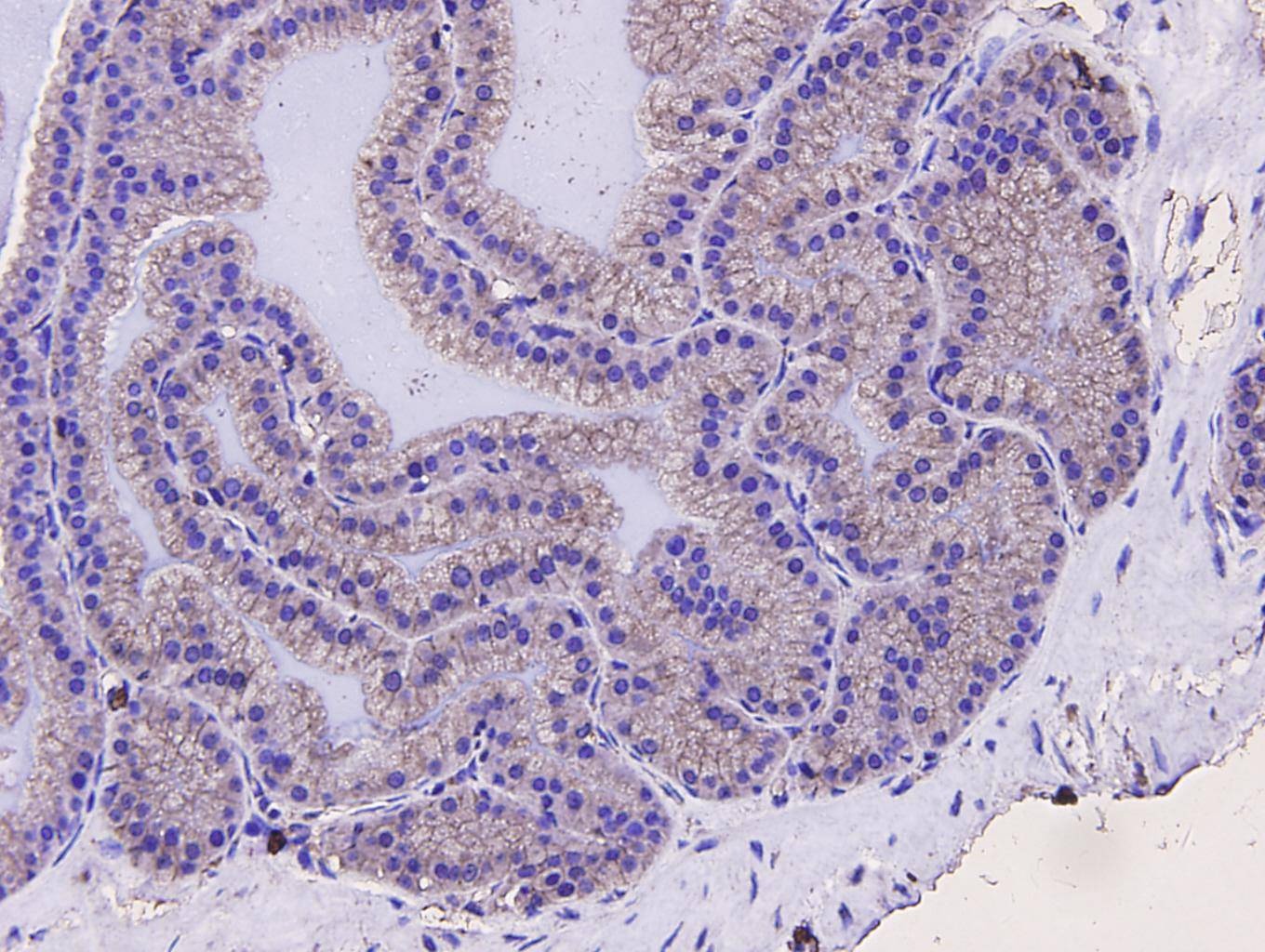 Anti-Sequestosome-1 Antibody (4X151)