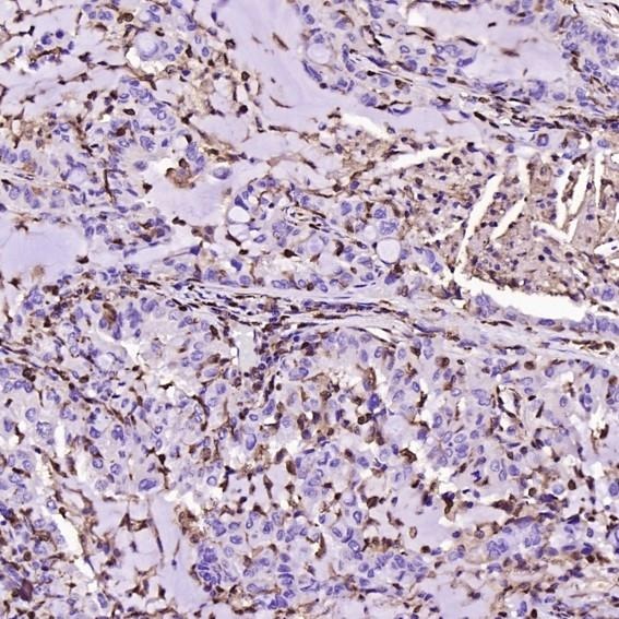 Anti-S100A4 Antibody (9W585)