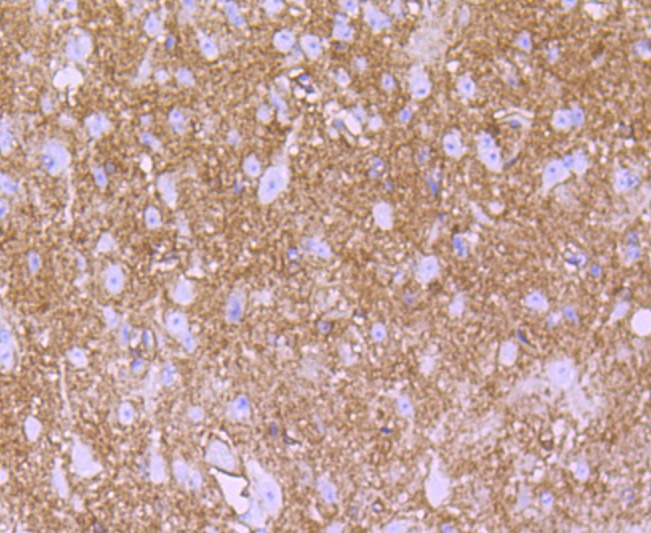 Anti-S100A1 Antibody (2K17)