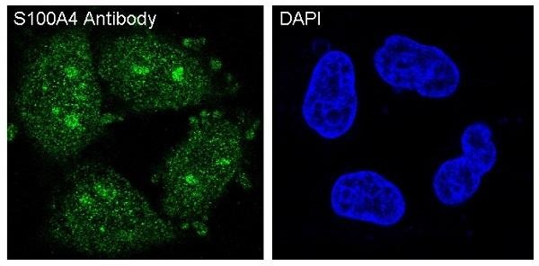Anti-S100A4 Antibody (9W585)