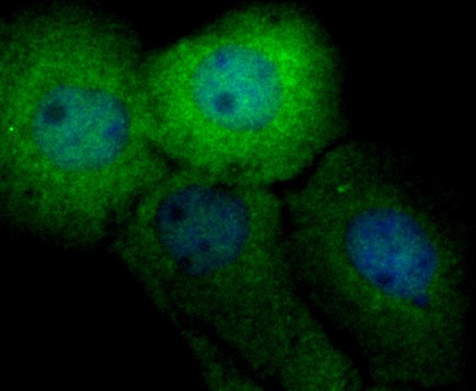 Anti-Securin Antibody (7P480)