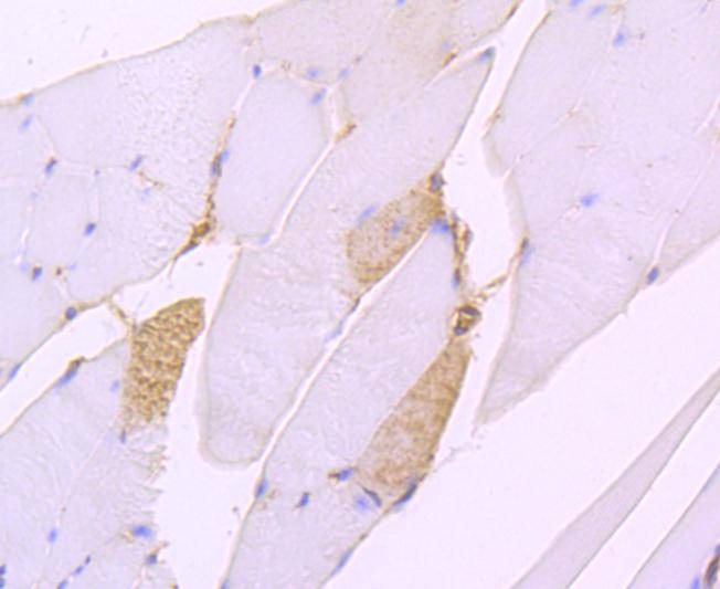Anti-ATP2A2 Antibody (2R687)