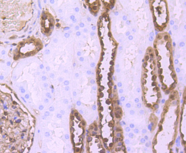 Anti-S100A6 Antibody (9N771)