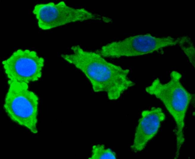 Anti-S100B Antibody (4A182)