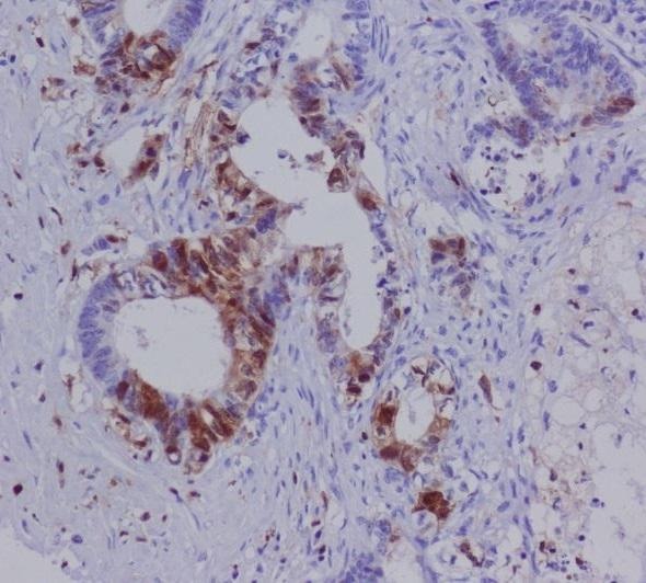 Anti-S100A4 Antibody (9W585)
